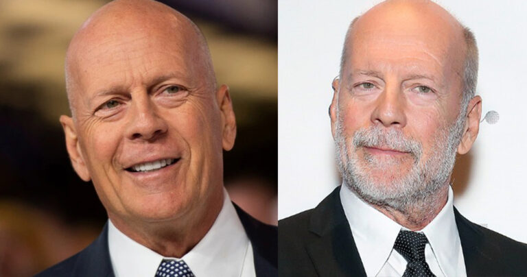 Τέλος η υποκριτική για τον  Μπρους Γουίλις – Διαγνώστηκε με αφασία