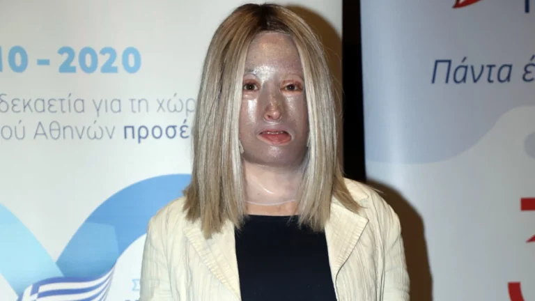 Ιωάννα Παλιοσπύρου: Έβγαλε την μάσκα για πρώτη φορά