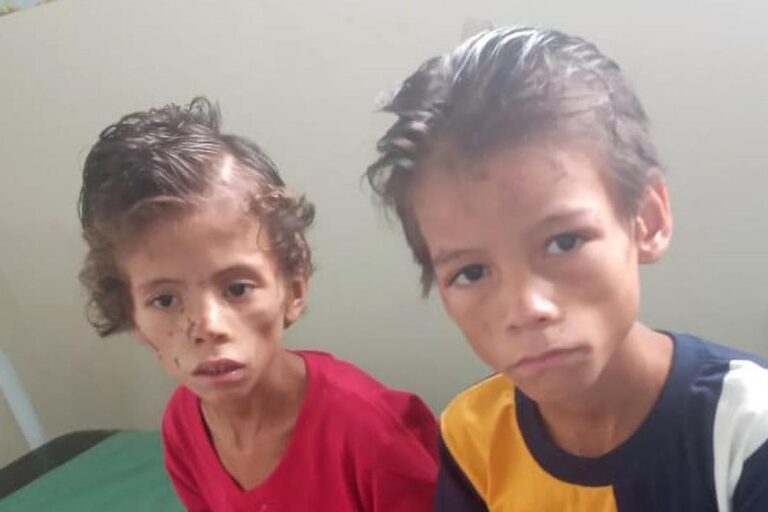 Δύο παιδιά επέζησαν επί 3 εβδομάδες στη ζούγκλα του Αμαζονίου – Βρέθηκαν κατά τύχη