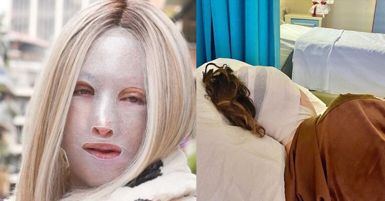 Δύσκολες ώρες για την Ιωάννα Παλιοσπύρου: Παρουσίασε σοβαρή επιπλοκή και μπαίνει για 11ο χειρουργείο