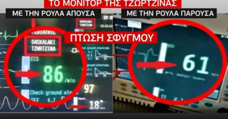 Ρούλα Πισπιρίγκου: Παρατεταμένη χορήγηση κεταμίνης ή δεύτερης ουσίας στη Τζωρτζίνα