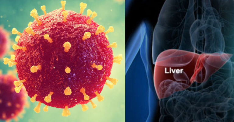 Συναγερμός στη Βρετανία για άγνωστη μορφή ηπατίτιδας – Τουλάχιστον 70 παιδιά στο νοσοκομείο