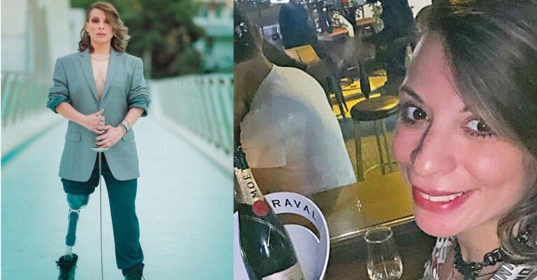 Τα έκανε άνω κάτω: Χαμογελά ξανά η Πένυ Σκάρου μετά το τροχαίο που της στοίχισε το πόδι της