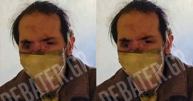 Θύμιος Μπουγάς: Χωρίς χρήματα, ταυτότητα, χωρίς ίχνη ζωής επί 18μερες – Ευχόμαστε να επιβιώνει
