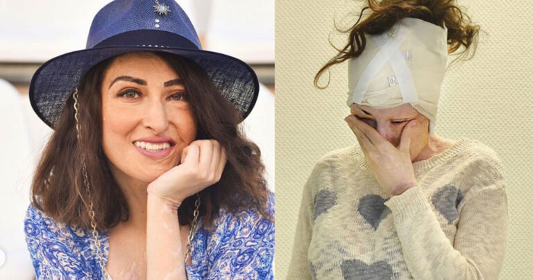 Δύναμη ψυχής: Η Ιωάννα Παλιοσπύρου δείχνει το πρόσωπό της χωρίς μακιγιάζ μετά την επίθεση με το βιτριόλι