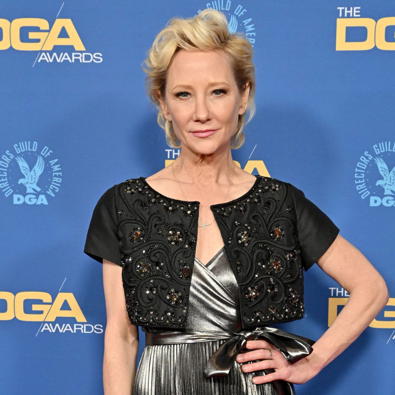 anne heche crash 080622 2000 eb97e43d8ba94f0caf8b7d06312a9def