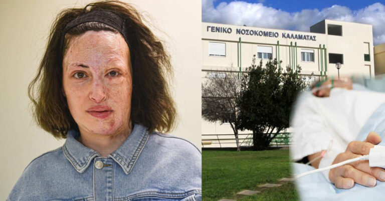 Η Ιωάννα Παλιοσπύρου στο πλευρό της 49χρονης που δέχτηκε επίθεση με χημικό υγρό στην Μεσσήνη