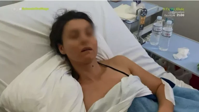 Σοκάρει η 34χρονη για την επίθεση από αγέλη σκύλων: «Με κατασπάραξαν – Με δάγκωσαν παντού, έχω μώλωπες και ράμματα»
