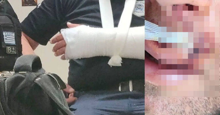 Λάρισα – Στο νοσοκομείο δύο από τους αστυνομικούς που τους επιτέθηκαν 30 άτομα