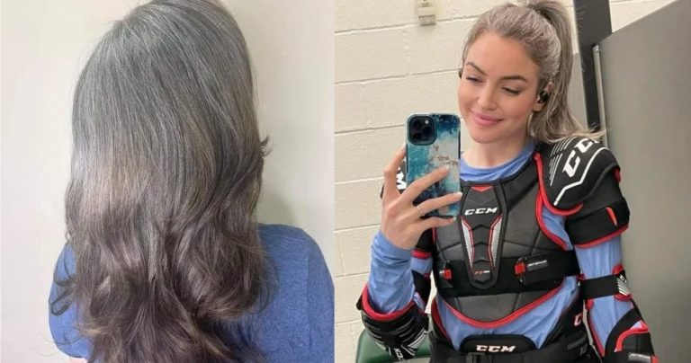 Είχε γκρίζα μαλλιά από τα 16 και όλοι τη κορόιδευαν – Έδινε 1.000 το χρόνο σε βαφές, αλλά σήμερα στέλνει ένα ηχηρό μήνυμα