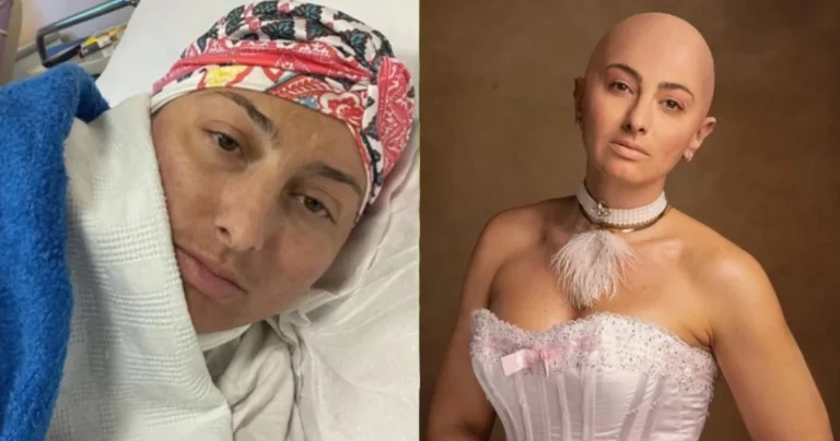 Με θάρρος & περηφάνεια: Η Ρεγγίνα Μακέδου βγάζει το τουρμπάνι και στέλνει δυνατό μήνυμα κατά του καρκίνου