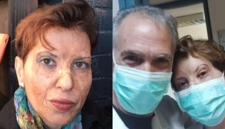 Καλλιόπη Αθανασιάδη: Η κορυφαία Ελληνίδα θωρακοχειρουργός του Ευαγγελισμού που πήγε ενάντια σε κάθε πρόβλεψη