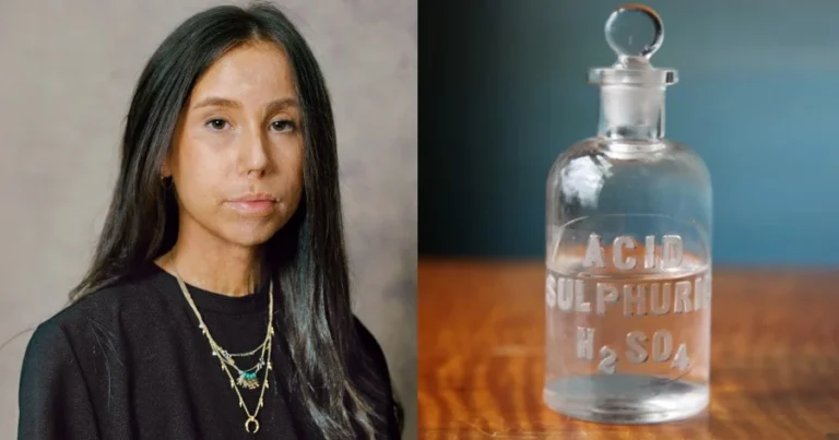 «Μου έριξαν βιτριόλι στο πρόσωπο επειδή είχα σχέση με παντρεμένο. Το έκαναν η σύζυγός του με τη κουμπάρα της»