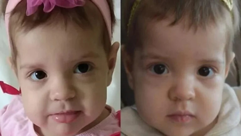 Η μικρή Άννα Αποστολία νίκησε τη λευχαιμία μετά από 1,5 χρόνο στο νοσοκομείο