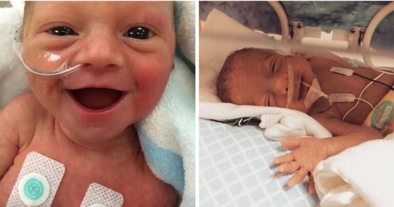 13 φωτογραφίες με πρόωρα μωράκια που χαμογελούν γιατί είναι ζωντανά