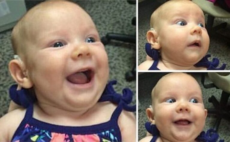 Η πανεπιστημιακή κλινικής του Α.Π.Θ «χάρισε ακοή» σε 25 μωράκια με βαριά βαρηκοΐα