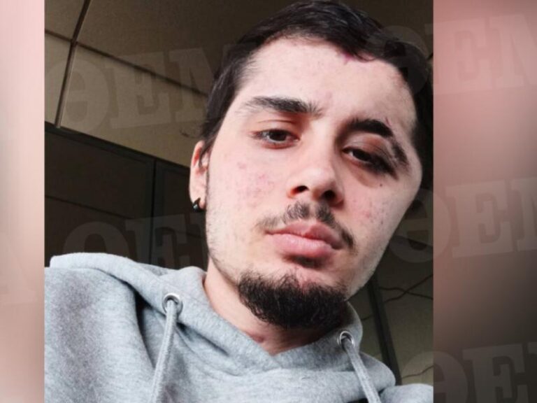 O 17χρονος που ξύπνησε από κώμα: «Προσπάθησα να μιλήσω στη μαμά μου αλλά δεν έβγαινε η φωνή μου»