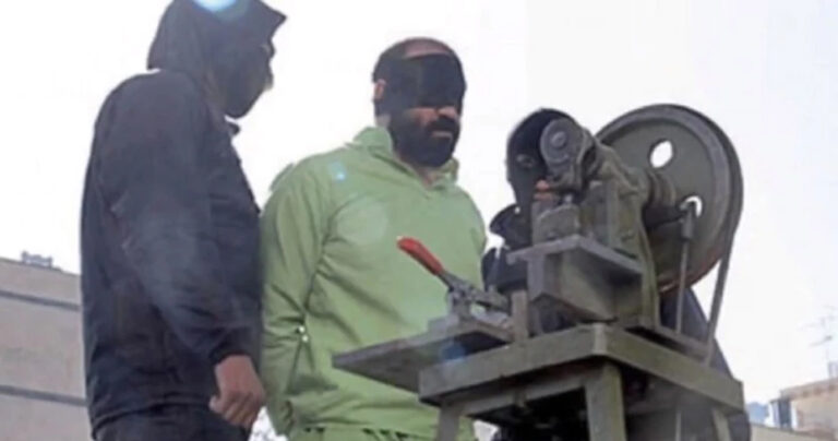 Ιράν: Άνδρας που κρίθηκε ένοχος για κλοπή υπέστη ακρωτηριασμό των δακτύλων του