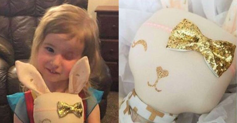 Έχασε το ματάκι της λόγω καρκίνου – Βρήκε τον εαυτό της χάρη σε μια κούκλα που της μοιάζει