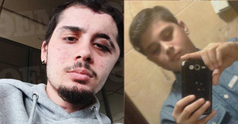 «Ζω ένα θαύμα, όλοι πίστευαν πως θα πεθάνω»: Συγκλονίζει ο  17χρονος που ξύπνησε από κώμα στη Λέσβο