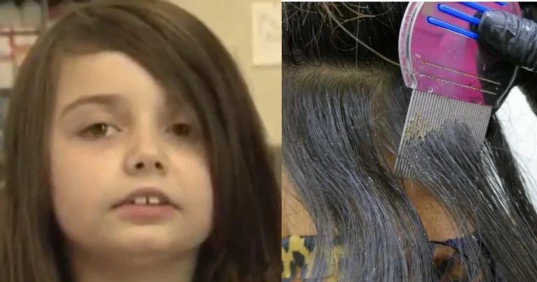 Tραγωδία σοκ – Πάγωσαν οι αστυνομικοί: Νεκρή 12χρονη από ψείρες, της ήπιαν όλο το αίμα, συνελήφθησαν οι γονείς