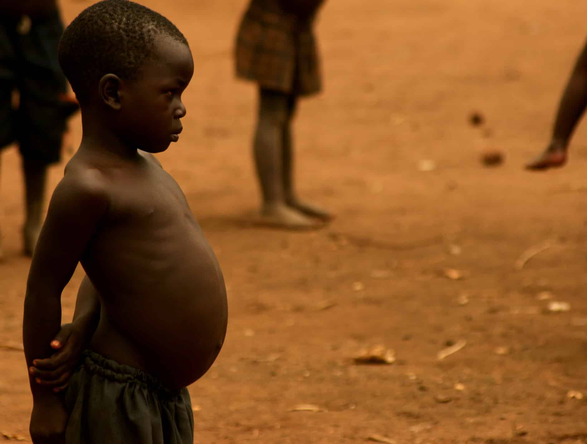 5 facts about hunger in sudan