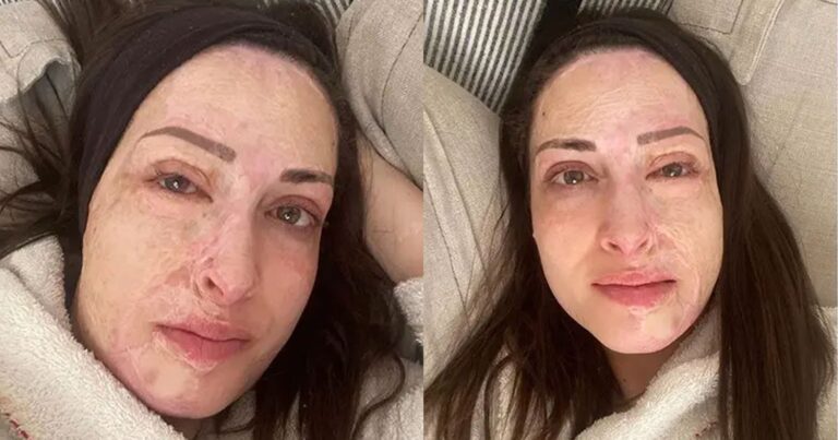 «Ακόμα παλεύω να αποδεχτώ τον νέο μου εαυτό»: Συγκινεί η Ιωάννα Παλιοσπύρου χωρίς μακιγιάζ