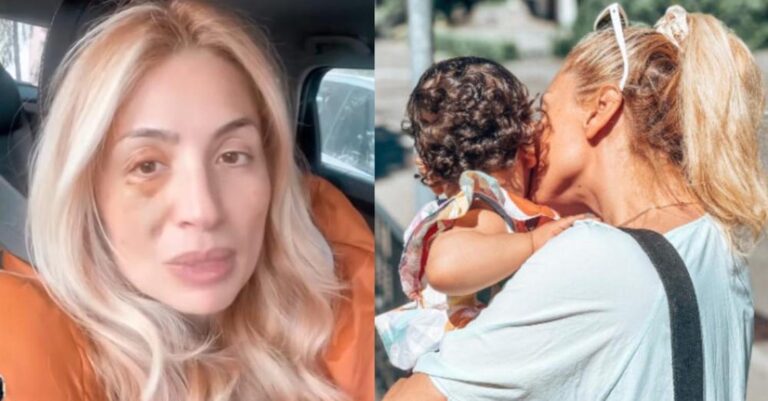 «Δεν μεγαλώνω παιδί»: Η Μαρία Ηλιάκη με μελανιασμένο μάτι περιγράφει το περιστατικό που συνέβη με την κόρη της