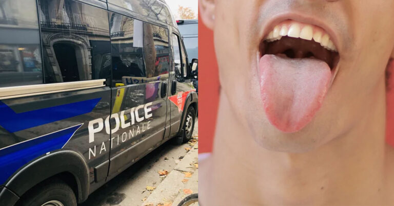 Γαλλία: Γυναίκα έκοψε τη γλώσσα του επίδοξου βιαστή της και την παρέδωσε στην αστυνομία