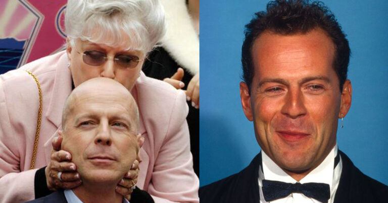 Μπρους Γουίλις: Δεν αναγνωρίζει ούτε τη μητέρα του – Η «κλονισμένη» υγεία του 