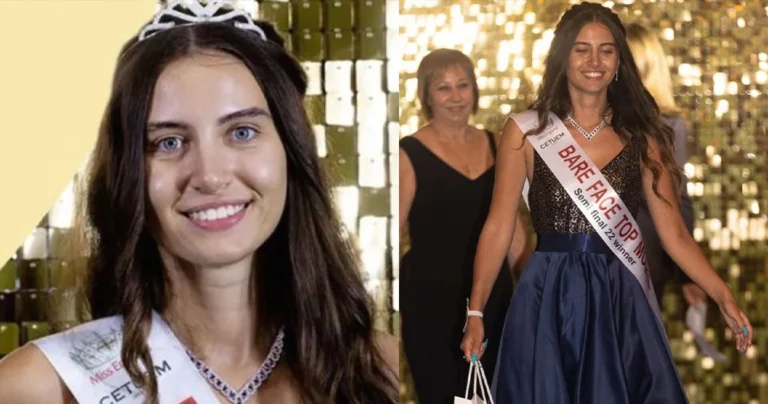 Η Μις Αγγλία γίνεται η πρώτη στην 94χρονη ιστορία των καλλιστείων που διαγωνίζεται χωρίς μακιγιάζ