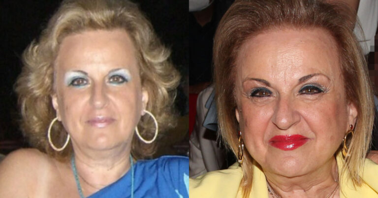 Ματίνα Παγώνη: «Βάφομαι από 17 ετών, έχει συνηθίσει το χέρι και πάει μόνο του»