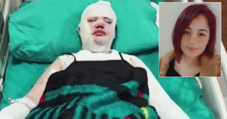 Τουρκία: Είπε στην πρώην του να την φιλοξενήσει μετά τον σεισμό και της έριξε καυτό νερό όταν κοιμόταν