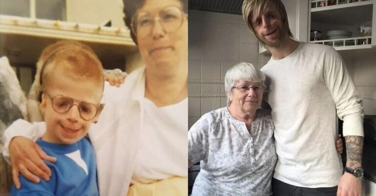 Η υπέροχη ιστορία του αγοριού με σύνδρομο TCS που εγκατέλειψαν οι γονείς του, αλλά τον διάλεξε η θετή μαμά του