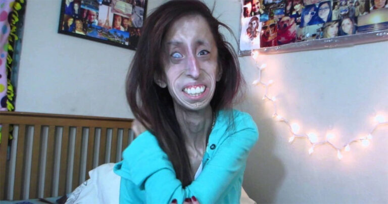 Την είπαν την ασχnμότερη γυναίκα στον κόσμο και μετά άλλαξε τη ζωή της μια για πάντα