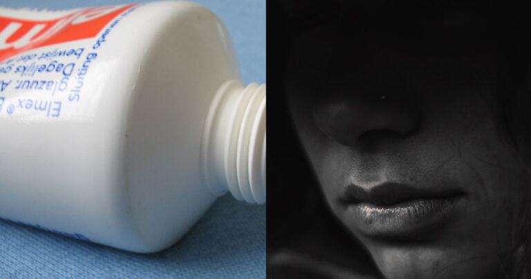 Θεσσαλονίκη: Σφήνωσε οδοντόκρεμα στο αιδοiο πρώnν συζύγου γνωστού επιχειρηματία