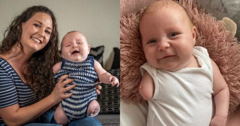 Η ιστορία που διχάζει το διαδίκτυο: Γυναίκα αρνήθηκε να «ρίξει» το μωρό της που γεννήθηκε χωρίς χέρι και πόδια