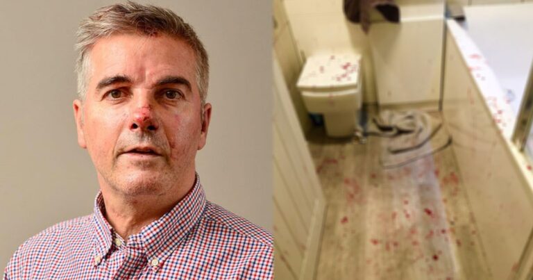 Ήρωας πατέρας «κομματιάστηκε» αλλά έσωσε την κόρη του από 5 βιαστές με ματσέτες και μαχαίρια