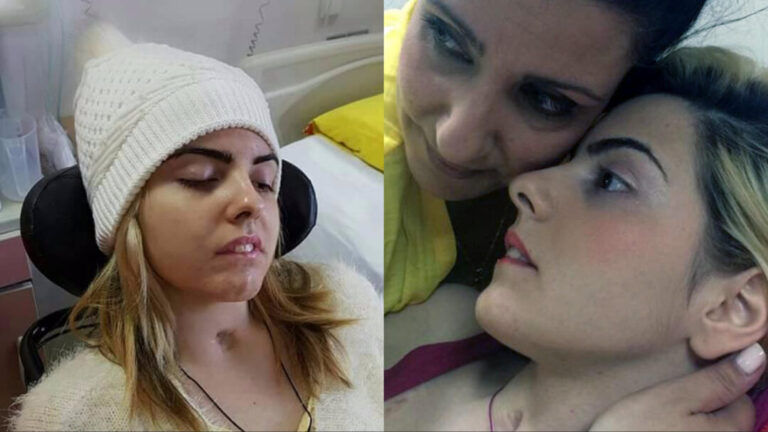 Κρίσιμες ώρες για την Άσπα που την είχε πυροβολήσει ο πατέρας της: Μπήκε εσπευσμένα στο νοσοκομείο