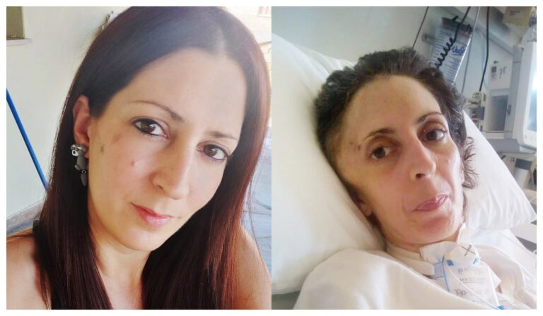 «Μετατοπίστηκε ο εγκέφαλός της»: Δύσκολες ώρες για την Όλγα που ξυλοκοπήθηκε άγρια από τον σύζυγό της – Τι λένε οι γονείς της