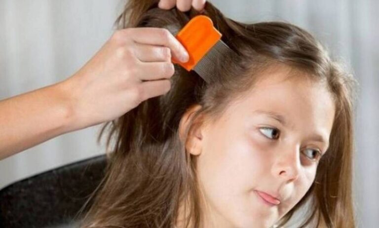 Τραγωδία σοκ: Νεκρή 12χρονη από ψείρες. Συνελήφθησαν οι γονείς