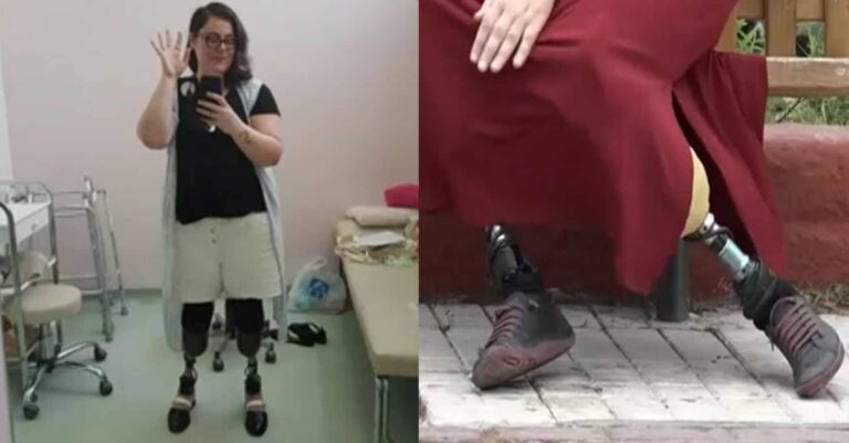 Η ιστορία της Ελισάβετ που ακρωτηριάστηκε όταν παρασύρθηκε από τρένο