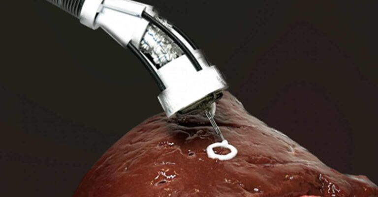 Κατασκευάζουν 3D βιοεκτυπωτή που θα επιδιορθώνει ανθρώπινα όργανα με βιομελάνι