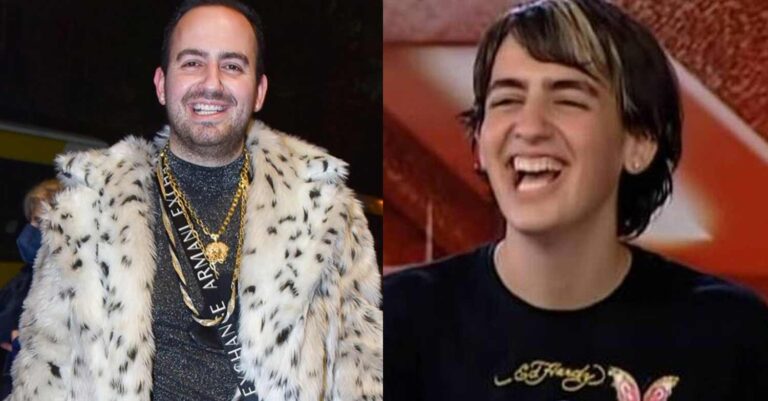 «Είδα το μαξιλάρι γεμάτο με τα μαλλιά μου»: Έμεινε φαλακρός ο Μαυρίκιος Μαυρικίου, η φώτο μέσα απ’το χειρουργείο