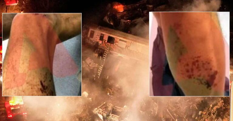 Τέμπη: Mυστηριώδη χημικά έκαψαν πυροσβέστες την νύχτα της τραγωδίας