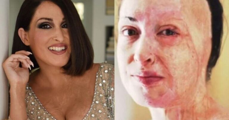 «Δεν νιώθω μίσος και θυμό»: Η Ιωάννα Παλιοσπύρου σπάει τη σιωπή της και συγκινεί για την επίθεση αλλά και για την γυναίκα που της επιτέθηκε