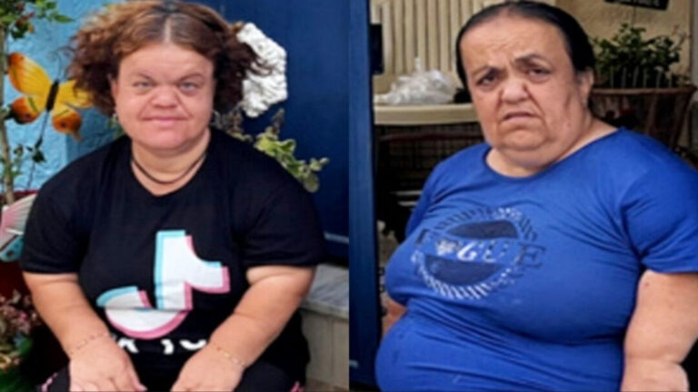 Κλαίει όλο το νησί: «Έφυγε» η Μαρία που έπασχε από νανισμό, άφησε μόνη την αδερφή της, Ελευθερία