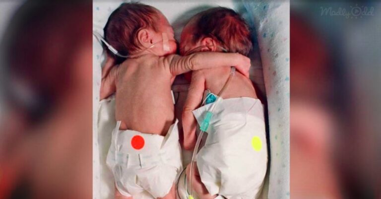 Πρόωρα δίδυμα αγκαλιάστηκαν στη θερμοκοιτίδα σώζοντας το ένα τη ζωή του άλλου
