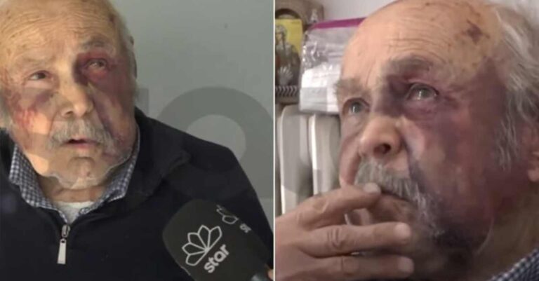 Άγριο ξύλο σε 90χρονο στη Χαλκίδα: Του έσπασαν και δόντια για 80 ευρώ – Οι εφιαλτικές στιγμές που έζησε