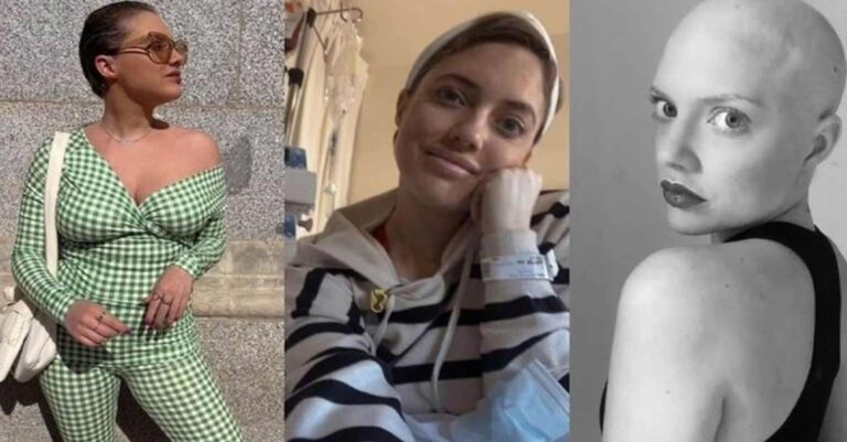 Στα 26 της διαγνώστηκε με μελάνωμα, πάλεψε επί 4 χρόνια αλλά νικήθηκε: Η ιστορία της Πατρίτσια από την Ισπανία έγινε viral